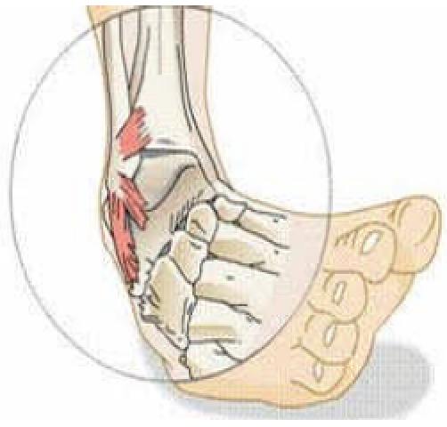 Ankle pain refers to any type