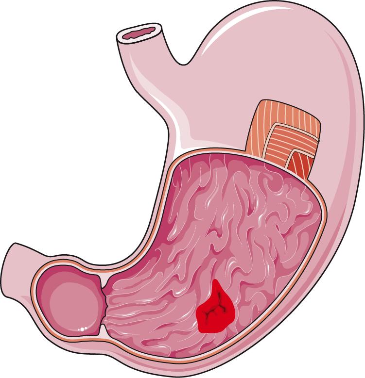 Stomach Png Hd Hdpng.com 751 - Stomach, Transparent background PNG HD thumbnail