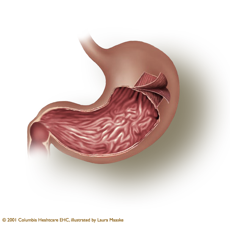 Stomach: The Gastric Layers - Stomach, Transparent background PNG HD thumbnail
