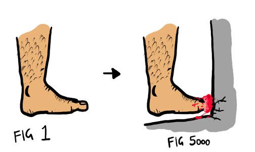 Broken Toe -- Foot Problems a