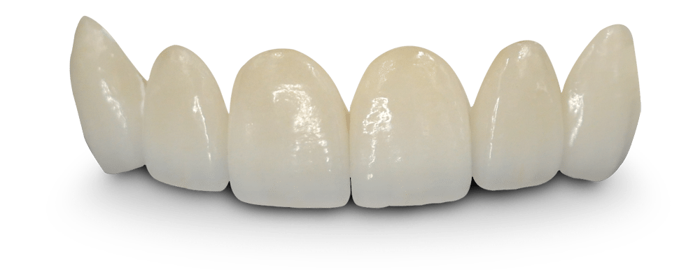 Dental Bridges - Teeth, Transparent background PNG HD thumbnail