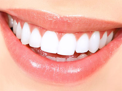 Brushing And Flossing Are Everyday Ways To Keep Your Teeth Bright, White And Healthy. Still, You May Feel Like Your Smile Is Lacking That Bright White Hdpng.com  - Teeth Smile, Transparent background PNG HD thumbnail