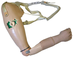 . Hdpng.com Body Also Gives The Patient Sensory Feedback. However, The Degree Of Sensory Feedback Depends On The Fit Of The Prosthetic Socket, The Harness As Well Hdpng.com  - Upper Limbs, Transparent background PNG HD thumbnail