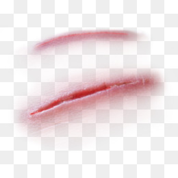 Wound Png Image PNG Image