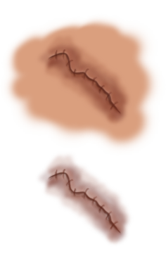 Wound Blood Png Image PNG Ima